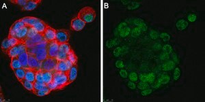 Anti-GLS2 Antibody, clone 3G12 ZooMAb® Rabbit Monoclonal recombinant, expressed in HEK 293 cells