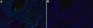 Anti-MCP-1 Antibody, clone 2G17 ZooMAb&#174; Rabbit Monoclonal recombinant, expressed in HEK 293 cells