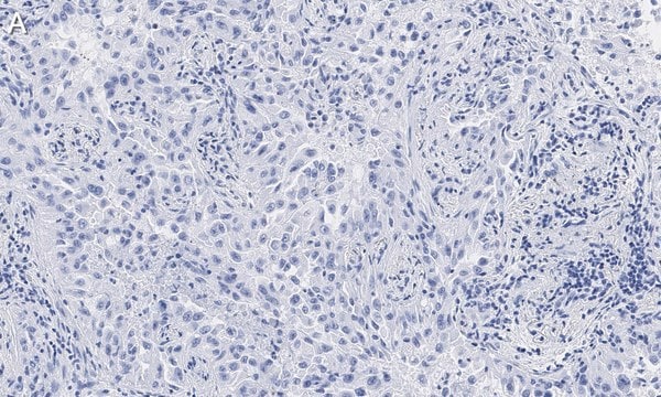 Anti-Integrin &#945;V&#946;8 Antibody, clone EM13309 , ZooMAb&#174; Rabbit Monoclonal recombinant, expressed in HEK 293 cells