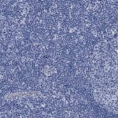 Anti-SLC34A3 antibody produced in rabbit Prestige Antibodies&#174; Powered by Atlas Antibodies, affinity isolated antibody, buffered aqueous glycerol solution