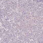 抗-TSPAN8 兔抗 Prestige Antibodies&#174; Powered by Atlas Antibodies, affinity isolated antibody, buffered aqueous glycerol solution