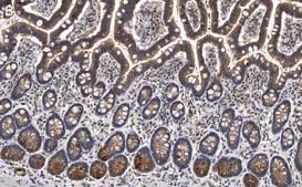 Anti-Gab1 Antibody, clone 4B20, ZooMAb&#174; Rabbit Monoclonal recombinant, expressed in HEK 293 cells