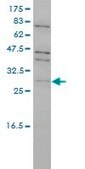 Monoclonal Anti-TP53RK antibody produced in mouse clone 4B9-1H3, purified immunoglobulin, buffered aqueous solution