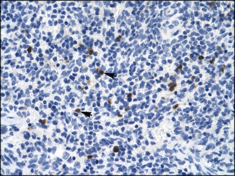 Anti-HTR3B antibody produced in rabbit affinity isolated antibody