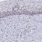 Anti-SIRT7 antibody produced in rabbit Prestige Antibodies® Powered by Atlas Antibodies, affinity isolated antibody, buffered aqueous glycerol solution