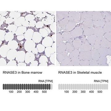 Anti-RNASE3 antibody produced in rabbit Prestige Antibodies&#174; Powered by Atlas Antibodies, affinity isolated antibody, buffered aqueous glycerol solution