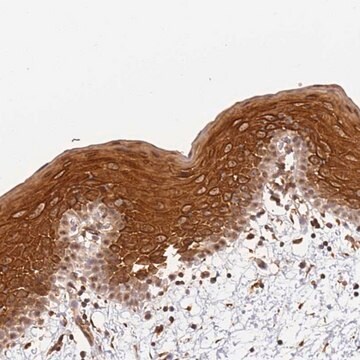 Anti-SURF2 antibody produced in rabbit Prestige Antibodies&#174; Powered by Atlas Antibodies, affinity isolated antibody, buffered aqueous glycerol solution
