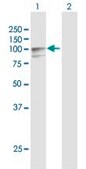 Anti-PLOD2 antibody produced in rabbit purified immunoglobulin, buffered aqueous solution