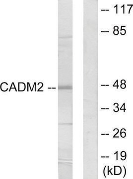 Anti-CADM2 antibody produced in rabbit affinity isolated antibody