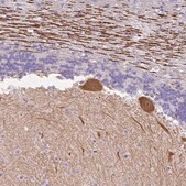Anti-MYO6 antibody produced in rabbit Prestige Antibodies&#174; Powered by Atlas Antibodies, affinity isolated antibody, buffered aqueous glycerol solution