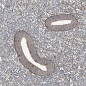 Anti-SAMD3 antibody produced in rabbit Prestige Antibodies® Powered by Atlas Antibodies, affinity isolated antibody, buffered aqueous glycerol solution, ab2