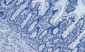 Anti-MKK3/MKK6 Antibody, clone 2E21 ZooMAb® Rabbit Monoclonal recombinant, expressed in HEK 293 cells