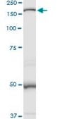 Anti-MAN2B1 antibody produced in rabbit purified immunoglobulin, buffered aqueous solution