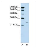 Anti-PLUNC antibody produced in rabbit affinity isolated antibody