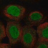 Anti-POM121 antibody produced in rabbit Prestige Antibodies&#174; Powered by Atlas Antibodies, affinity isolated antibody, buffered aqueous glycerol solution
