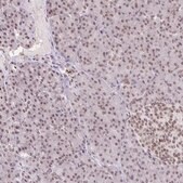 Anti-ORC3 antibody produced in rabbit Prestige Antibodies&#174; Powered by Atlas Antibodies, affinity isolated antibody, buffered aqueous glycerol solution