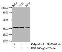 Anti-phospho-EIF2S1 (S51) antibody, clone 1C6, Rabbit Monoclonal recombinant, expressed in HEK293F cells