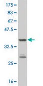ANTI-PBK antibody produced in mouse clone 2A3, purified immunoglobulin, buffered aqueous solution