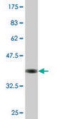 Monoclonal Anti-UPP1, (N-terminal) antibody produced in mouse clone 2F5, purified immunoglobulin, buffered aqueous solution