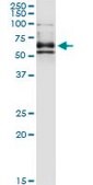 Monoclonal Anti-DPYSL4 antibody produced in mouse clone 1F5, purified immunoglobulin, buffered aqueous solution