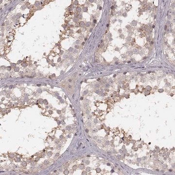 Anti-FAM13B antibody produced in rabbit Prestige Antibodies&#174; Powered by Atlas Antibodies, affinity isolated antibody