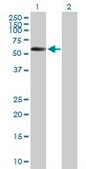 Anti-STK11 antibody produced in mouse purified immunoglobulin, buffered aqueous solution