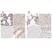 Anti-TKT antibody produced in rabbit Prestige Antibodies&#174; Powered by Atlas Antibodies, affinity isolated antibody, buffered aqueous glycerol solution, ab1