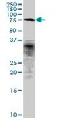 Anti-FLJ10996 antibody produced in mouse IgG fraction of antiserum, buffered aqueous solution