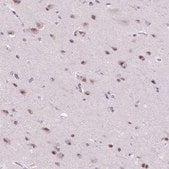 Anti-ZMAT4 antibody produced in rabbit Prestige Antibodies® Powered by Atlas Antibodies, affinity isolated antibody, buffered aqueous glycerol solution
