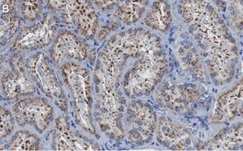 Anti-LAMP-2 Antibody, clone 1F6 ZooMAb® Rabbit Monoclonal recombinant, expressed in HEK 293 cells