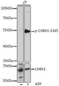 Anti-Phospho-CHEK1-S345 antibody produced in rabbit