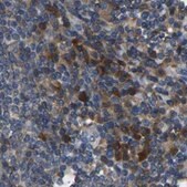 Anti-ATP8B1 antibody produced in rabbit Prestige Antibodies&#174; Powered by Atlas Antibodies, affinity isolated antibody, buffered aqueous glycerol solution, Ab2
