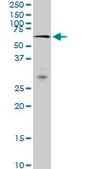 Monoclonal Anti-MAK, (C-terminal) antibody produced in mouse clone 3E5, purified immunoglobulin, buffered aqueous solution