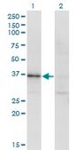 Monoclonal Anti-RBKS antibody produced in mouse clone 3B4, purified immunoglobulin, buffered aqueous solution