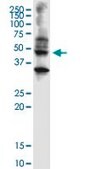 Monoclonal Anti-ABHD5 antibody produced in mouse clone 1F3, purified immunoglobulin, buffered aqueous solution