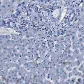 Anti-NACAD antibody produced in rabbit Prestige Antibodies&#174; Powered by Atlas Antibodies, affinity isolated antibody, buffered aqueous glycerol solution