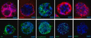 3dGRO® Breast Organoids (Donor 6)