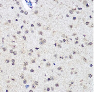 Anti-CTCF antibody produced in rabbit