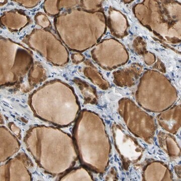 Anti-RIOX2 antibody produced in rabbit Prestige Antibodies&#174; Powered by Atlas Antibodies, affinity isolated antibody, buffered aqueous glycerol solution