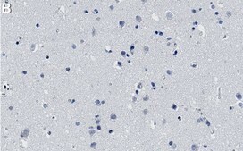 Anti-ROCK2 Antibody, clone 1B20 ZooMAb&#174; Rabbit Monoclonal recombinant, expressed in HEK 293 cells
