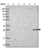 Anti-NBPF3 antibody produced in rabbit Prestige Antibodies&#174; Powered by Atlas Antibodies, affinity isolated antibody, buffered aqueous glycerol solution