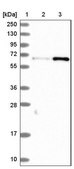 Anti-CTDSPL2 antibody produced in rabbit Prestige Antibodies&#174; Powered by Atlas Antibodies, affinity isolated antibody, buffered aqueous glycerol solution