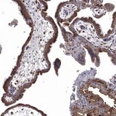 Anti-FES antibody produced in rabbit Prestige Antibodies&#174; Powered by Atlas Antibodies, affinity isolated antibody, buffered aqueous glycerol solution