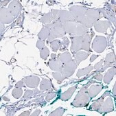 Anti-AHNAK2 antibody produced in rabbit Prestige Antibodies&#174; Powered by Atlas Antibodies, affinity isolated antibody, buffered aqueous glycerol solution