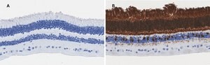 Anti-Recoverin Antibody, clone 1J23, ZooMAb&#174; Rabbit Monoclonal recombinant, expressed in HEK 293 cells