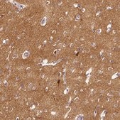 Anti-CAP2 antibody produced in rabbit Prestige Antibodies&#174; Powered by Atlas Antibodies, affinity isolated antibody, buffered aqueous glycerol solution