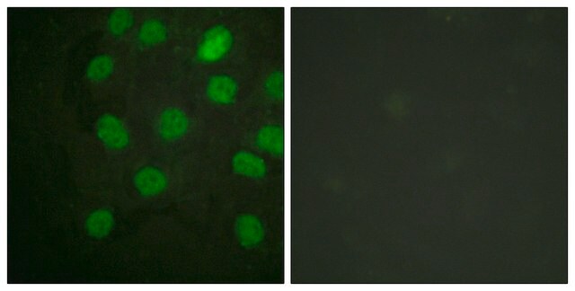 Anti-DNA-PK antibody produced in rabbit affinity isolated antibody