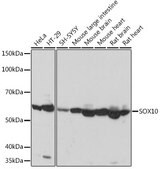 Anti-SOX10 Antibody, clone 2V5D6, Rabbit Monoclonal