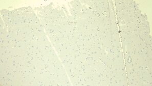Anti-DDB1 antibody produced in goat affinity isolated antibody, buffered aqueous solution