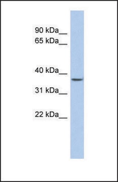 Anti-FOXE3, (N-terminal) antibody produced in rabbit affinity isolated antibody
